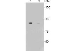 Image no. 3 for anti-Glycogen Synthase 1 (Muscle) (GYS1) (pSer641) antibody (ABIN5557475)