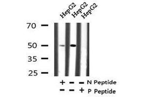 Image no. 3 for anti-Y Box Binding Protein 1 (YBX1) (pTyr162) antibody (ABIN6270078)