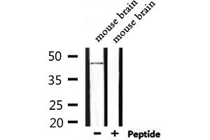 Image no. 2 for anti-Neuromedin U Receptor 1 (NMUR1) (N-Term) antibody (ABIN6263673)