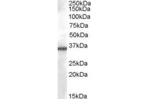 Image no. 2 for anti-Aldo-Keto Reductase Family 1, Member B10 (Aldose Reductase) (AKR1B10) (C-Term) antibody (ABIN238673)