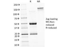 Image no. 3 for anti-Asparaginase Like 1 (ASRGL1) antibody (ABIN4949449)