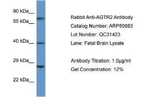 Image no. 1 for anti-Angiotensin II Receptor, Type 2 (AGTR2) (N-Term) antibody (ABIN2788290)