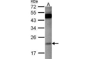 Image no. 1 for anti-RAP1B, Member of RAS Oncogene Family (RAP1B) (Center) antibody (ABIN2855239)