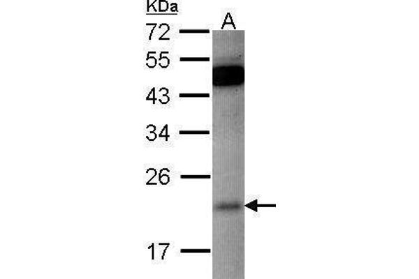 anti-RAP1B, Member of RAS Oncogene Family (RAP1B) (Center) antibody