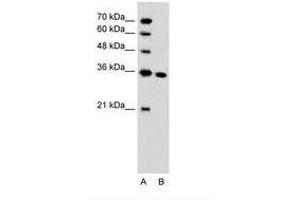 Image no. 1 for anti-Solute Carrier Family 25, Member 29 (SLC25A29) (C-Term) antibody (ABIN205008)
