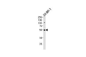 Image no. 1 for anti-SWI/SNF Related, Matrix Associated, Actin Dependent Regulator of Chromatin, Subfamily E, Member 1 (SMARCE1) (AA 307-335), (C-Term) antibody (ABIN5530477)