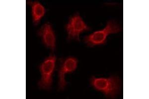 Image no. 2 for anti-Synaptic Vesicle 2-Related Protein (SVOP) antibody (ABIN6259483)