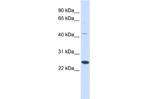 Image no. 1 for anti-Family With Sequence Similarity 119A (FAM119A) (Middle Region) antibody (ABIN2785118)