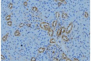 ABIN6279020 at 1/100 staining Mouse kidney tissue by IHC-P.