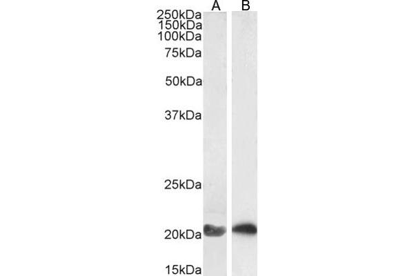 GTPase NRas 抗体  (Internal Region)