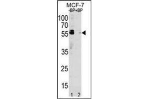 Image no. 3 for anti-Sequestosome 1 (SQSTM1) (AA 324-353), (C-Term) antibody (ABIN1449619)