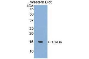 Image no. 1 for anti-Prostate Stem Cell Antigen (PSCA) (AA 22-95) antibody (ABIN1860333)