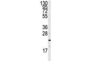 Image no. 4 for anti-GTPase NRas (NRAS) (AA 72-101) antibody (ABIN3031130)
