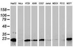 Image no. 2 for anti-NADH Dehydrogenase (Ubiquinone) 1 beta Subcomplex, 9, 22kDa (NDUFB9) (AA 3-179) antibody (ABIN1491362)