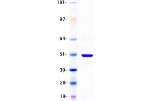 Image no. 1 for Cytochrome P450, Family 2, Subfamily D, Polypeptide 6 (CYP2D6) protein (DYKDDDDK Tag) (ABIN2712769)
