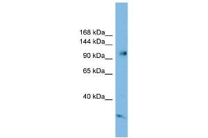 Image no. 1 for anti-Serine/threonine-Protein Phosphatase 4 Regulatory Subunit 3A (SMEK1) (Middle Region) antibody (ABIN2787340)