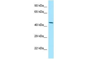 Image no. 1 for anti-Matrix Metallopeptidase 28 (MMP28) (C-Term) antibody (ABIN2789962)