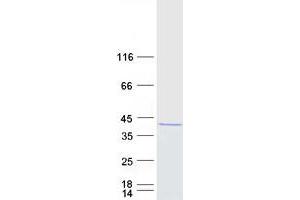 Image no. 1 for Protein Arginine Methyltransferase 6 (PRMT6) protein (Myc-DYKDDDDK Tag) (ABIN2729674)