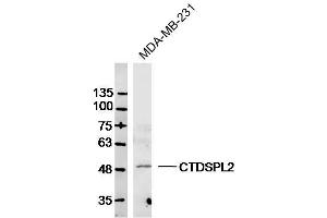 Image no. 1 for anti-CTD (Carboxy-Terminal Domain, RNA Polymerase II, Polypeptide A) Small Phosphatase Like 2 (CTDSPL2) (AA 11-110) antibody (ABIN1385639)