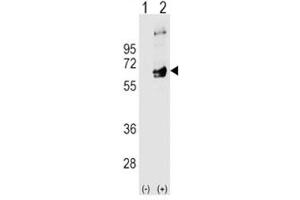 Image no. 2 for anti-FYN Oncogene Related To SRC, FGR, YES (FYN) (AA 13-43) antibody (ABIN3031009)