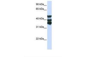 Image no. 1 for anti-Homogentisate 1,2-Dioxygenase (HGD) (AA 252-301) antibody (ABIN6738765)