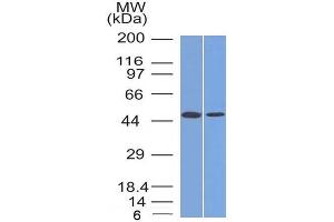 Image no. 5 for anti-Forkhead Box A1 (FOXA1) (AA 372-472) antibody (ABIN6939651)