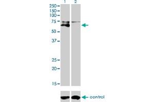 Image no. 1 for anti-Alkaline Phosphatase, Liver/bone/kidney (ALPL) (AA 91-200) antibody (ABIN559858)