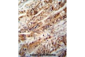 Image no. 1 for anti-Zinc Finger CCCH-Type Containing 15 (ZC3H15) (AA 370-399), (C-Term) antibody (ABIN955636)