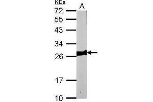 Image no. 2 for anti-Myosin, Light Chain 3 (MYL3) (Center) antibody (ABIN2855521)