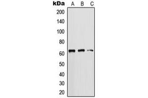 Western blot analysis of Cytokeratin 5 expression in DU145 (A), HeLa (B), MCF7 (C) whole cell lysates.