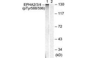 Western blot analysis of extracts from HepG2 cells, using EPHA2/3 (Phospho-Tyr588/596) Antibody.