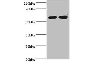 Western blot All lanes: P4HA2 antibody at 6 μg/mL Lane 1: HepG2 whole cell lysate Lane 2: 293T whole cell lysate Secondary Goat polyclonal to rabbit IgG at 1/10000 dilution Predicted band size: 61 kDa Observed band size: 61 kDa