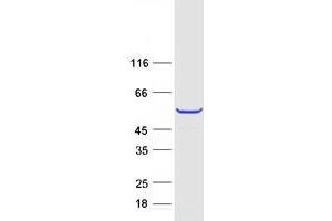Image no. 1 for Tektin 2 (Testicular) (TEKT2) protein (Myc-DYKDDDDK Tag) (ABIN2733405)