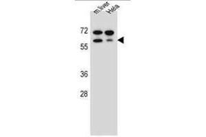 Image no. 1 for anti-T-Box 6 (TBX6) (AA 150-180), (Middle Region) antibody (ABIN955115)