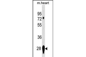 CNS2 Antibody (Center) 19354c western blot analysis in mouse heart tissue lysates (35 μg/lane).