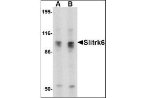 Image no. 2 for anti-SLIT and NTRK-Like Family, Member 6 (SLITRK6) (C-Term) antibody (ABIN500770)