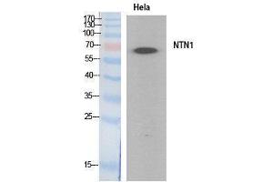 Image no. 1 for anti-Netrin 1 (NTN1) (Internal Region) antibody (ABIN3181063)
