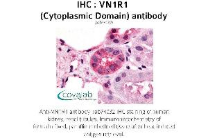 Image no. 1 for anti-Vomeronasal 1 Receptor 1 (VN1R1) (1st Cytoplasmic Domain) antibody (ABIN1740732)