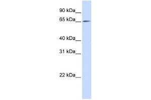 Image no. 1 for anti-Neuroepithelial Cell Transforming 1 (NET1) (N-Term) antibody (ABIN631712)
