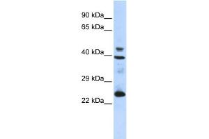 Image no. 1 for anti-Selenoprotein P (SEPP1) (N-Term) antibody (ABIN2774140)