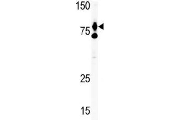 HGF antibody  (AA 521-554)