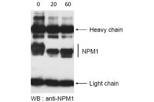 Western Blotting (WB) image for Lambda Protein Phosphatase (ABIN2451908)