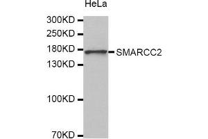 Image no. 1 for anti-SWI/SNF Related, Matrix Associated, Actin Dependent Regulator of Chromatin, Subfamily C, Member 2 (SMARCC2) antibody (ABIN3022693)