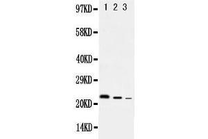 Image no. 1 for anti-Interleukin 10 (IL10) (AA 19-178) antibody (ABIN3042802)