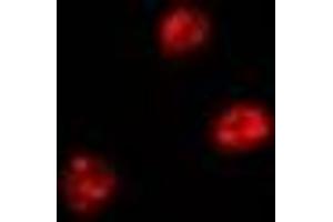 Image no. 1 for anti-FERM, RhoGEF and Pleckstrin Domain Protein 2 (FARP2) antibody (ABIN2966640)
