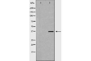 Image no. 2 for anti-Proteasome (Prosome, Macropain) 26S Subunit, Non-ATPase, 7 (PSMD7) (C-Term) antibody (ABIN6264491)