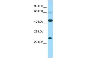 CABS1 antibody  (N-Term)
