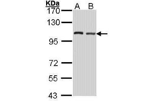 Image no. 2 for anti-Eukaryotic Translation Initiation Factor 4 gamma 2 (EIF4G2) (C-Term) antibody (ABIN2855138)