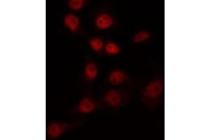 Image no. 2 for anti-Forkhead Box L1 (FOXL1) antibody (ABIN6261793)