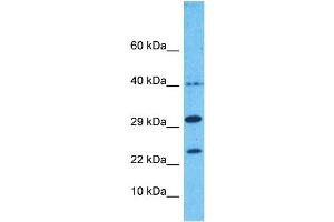 Image no. 1 for anti-Nudix (Nucleoside Diphosphate Linked Moiety X)-Type Motif 1 (NUDT1) (Middle Region) antibody (ABIN5514381)